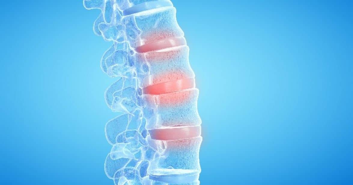 Spine diagnosis for 3D printing process